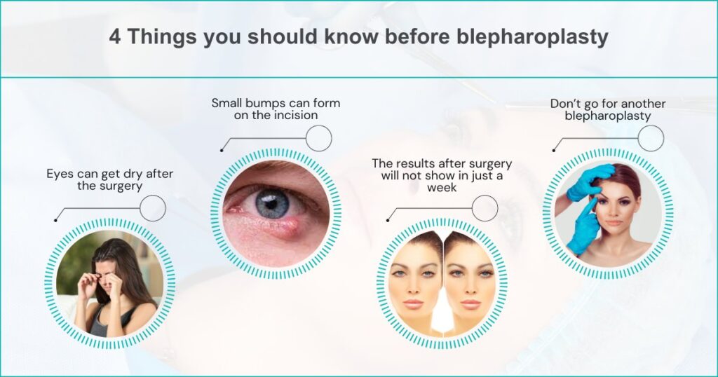 4 Things you should know before blepharoplasty.jpg