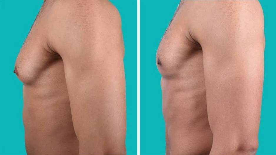 Man boobs: Five simple exercises for men that help eradicate the