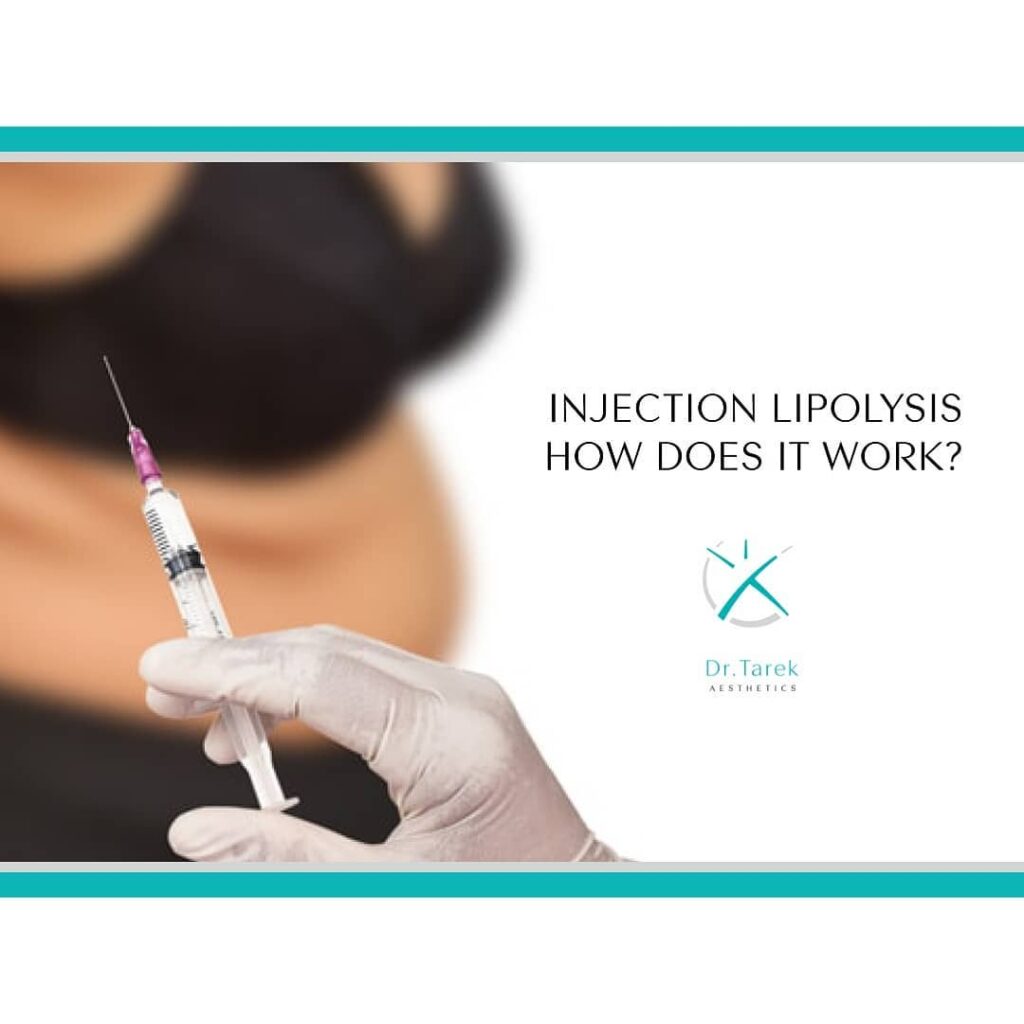Injection Lipolysis Dubai