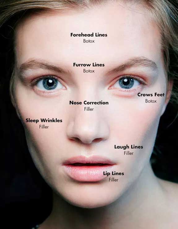 Botox Procedure In Dubai