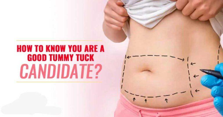How To Know If A Tummy Tuck Is Right For You