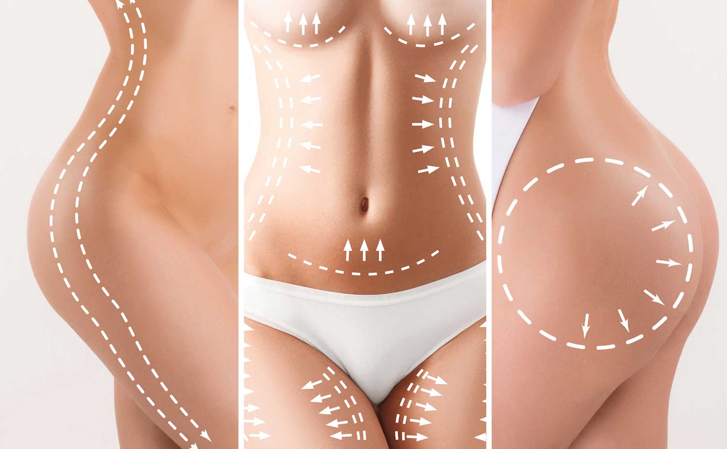 Perfect for Abdominoplasty or “tummy tuck”. Abdominoplasty or tummy tuck  is a cosmetic surgery procedure used to make the abdomen…