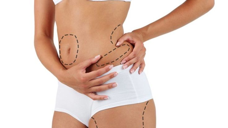 Cost Of Liposuction In Uae