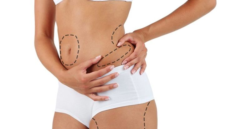 Liposuction Cost In Dubai