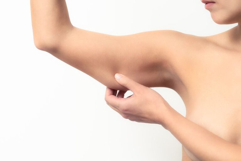 Liposuction Arms