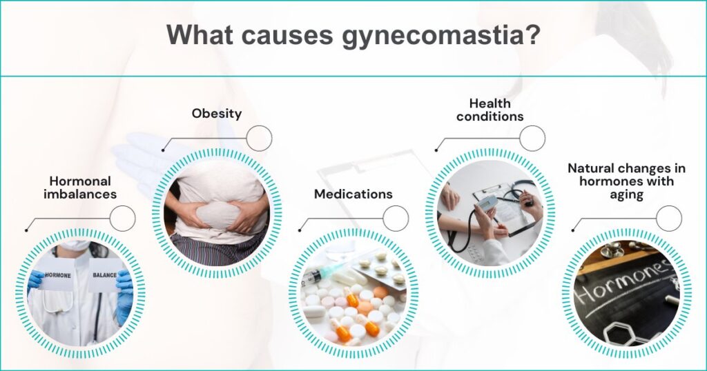 What Causes Gynecomastia