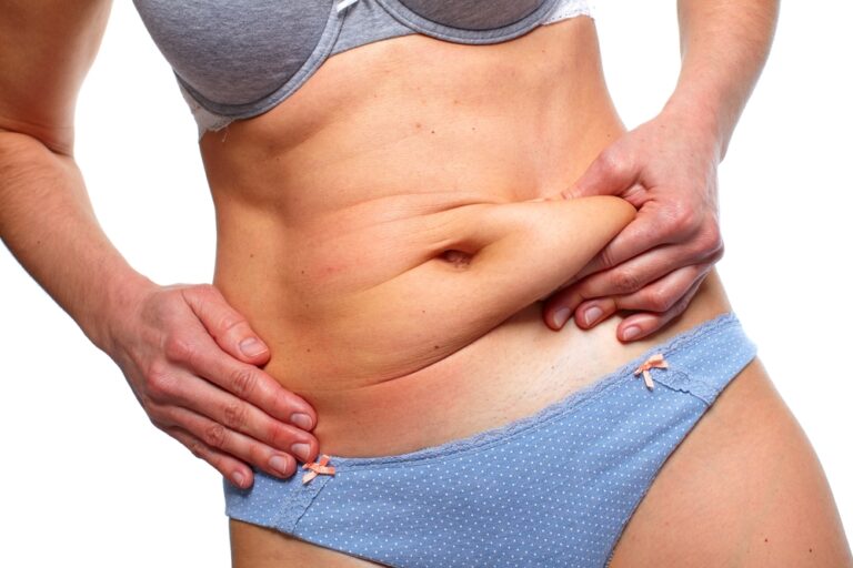 Extended Tummy Tuck (Body Lift)