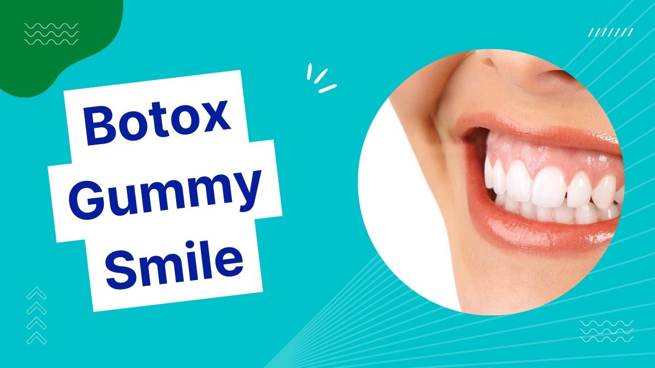 Botox Gummy Smile