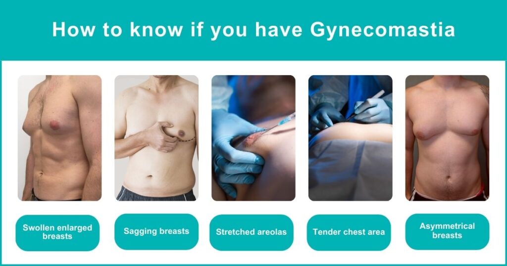 Gynecomastia Latest Treatment Gynecomastia Latest Treatment