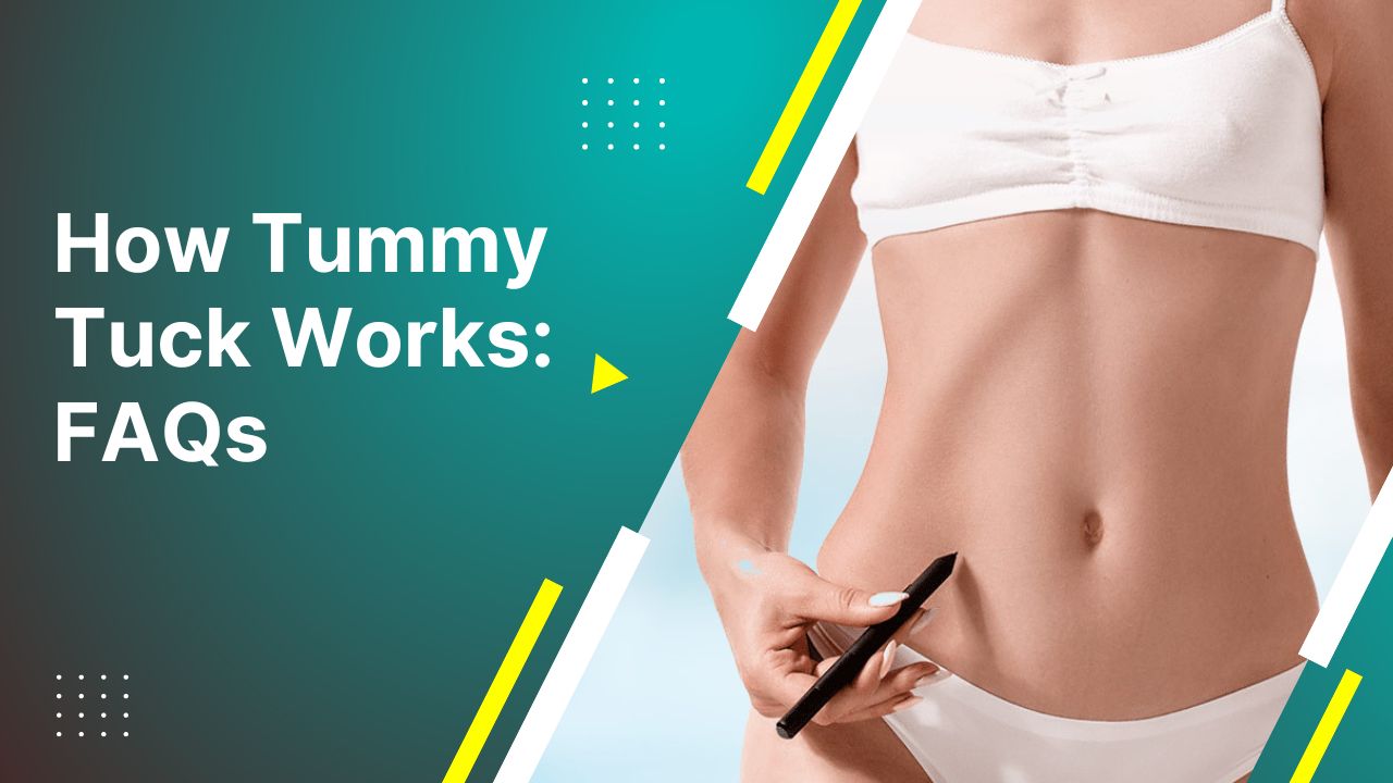 How Tummy Tuck Works Frequently Asked Questions