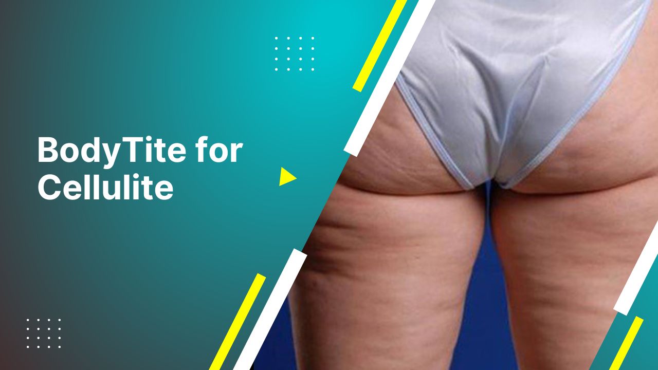 Bodytite For Cellulite