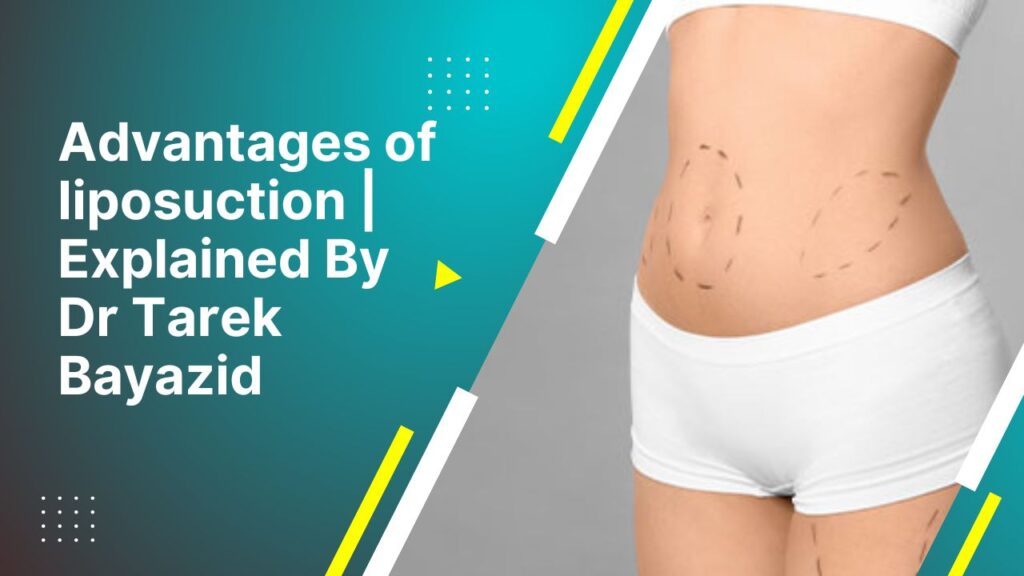 Advantages Of Liposuction Explained By Dr. Tarek Bayazid 2024