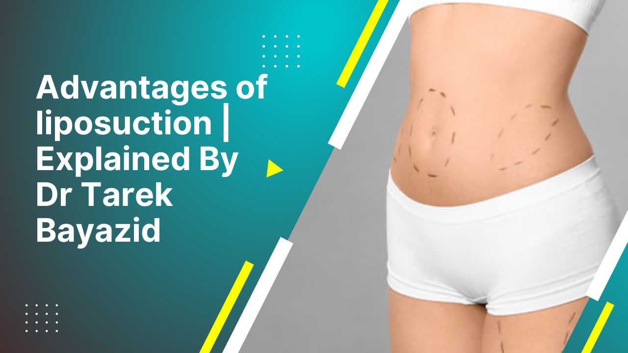 Advantages Of Liposuction Explained By Dr Tarek Bayazid