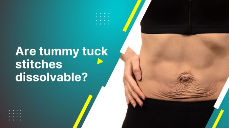 Are Tummy Tuck Stitches Dissolvable?