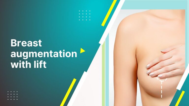 Breast Augmentation With Lift | Benefits Of Breast Augmentation With Breast Lift