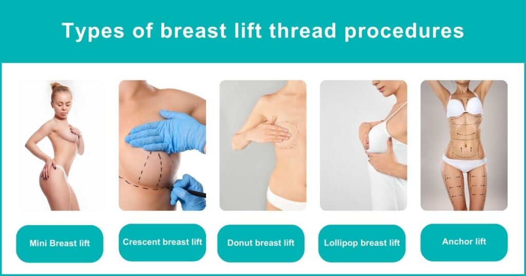 Breast Lift With Threads