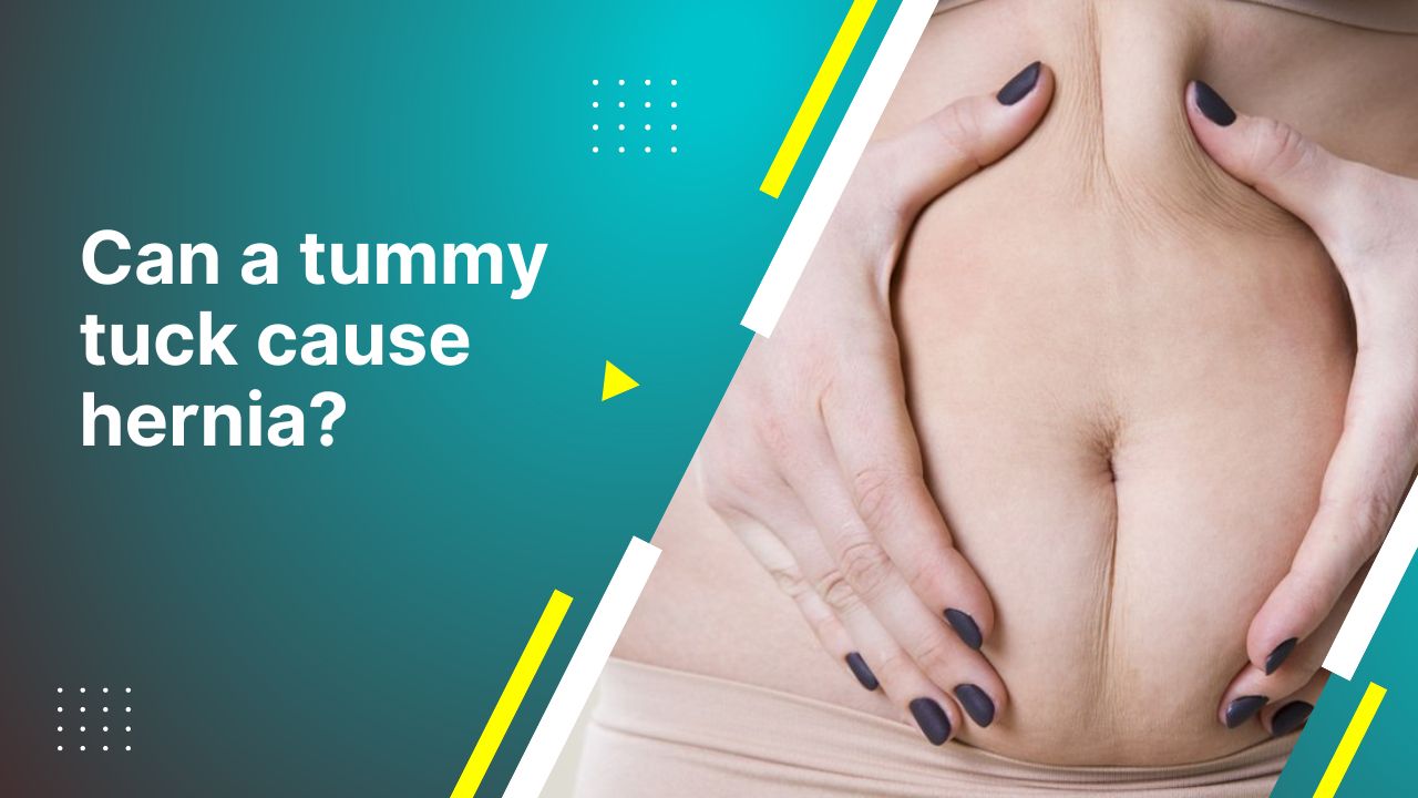 Can A Tummy Tuck Cause Hernia? 2024