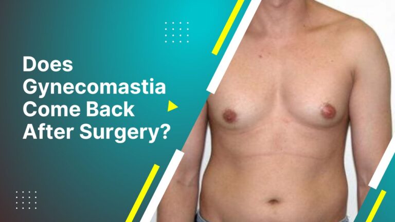 Does Gynecomastia Come Back After Surgery?