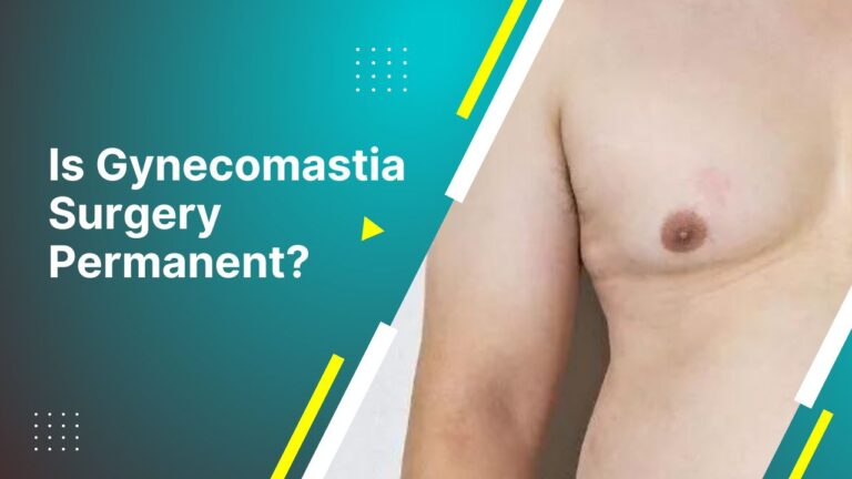 Is Gynecomastia Surgery Permanent?