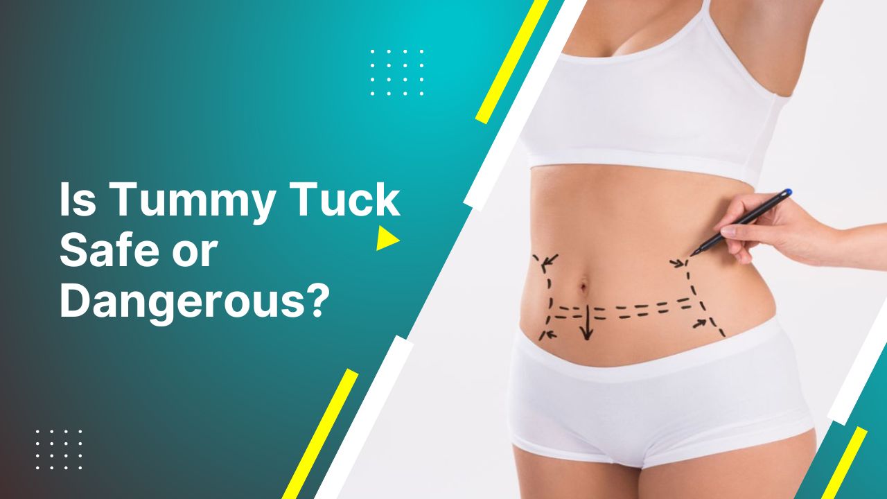 Is Tummy Tuck Safe Or Dangerous? As Explained By Dr. Tarek Bayazid 2024