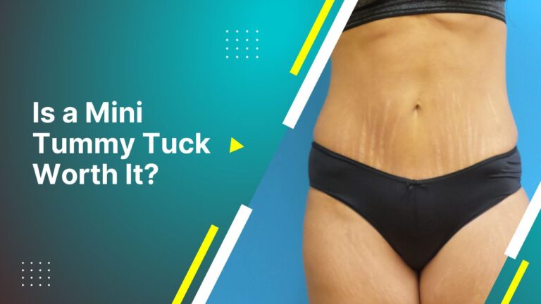 Is A Mini Tummy Tuck Worth It?