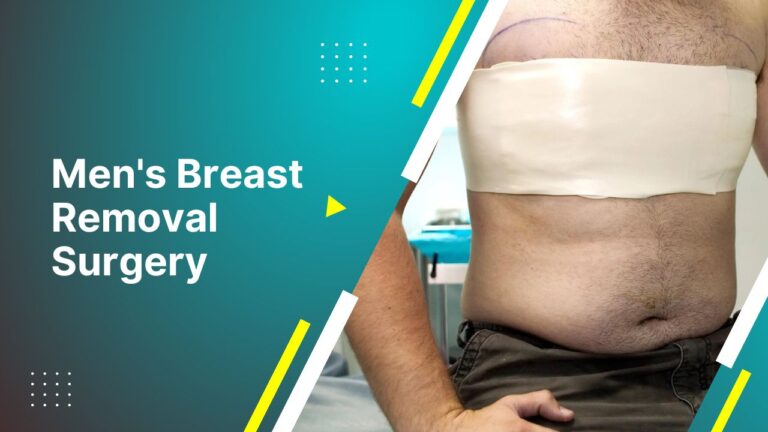 Men’S Breast Removal Surgery | Liposuction For Man Chests