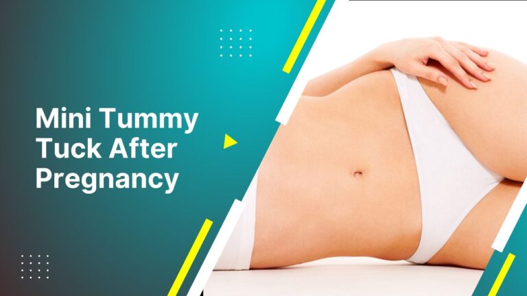 Mini Tummy Tuck After Pregnancy | Tips By Dr. Tarek Bayazid