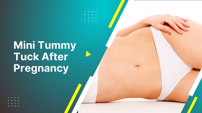 Mini Tummy Tuck After Pregnancy Tips By Dr. Tarek Bayazid