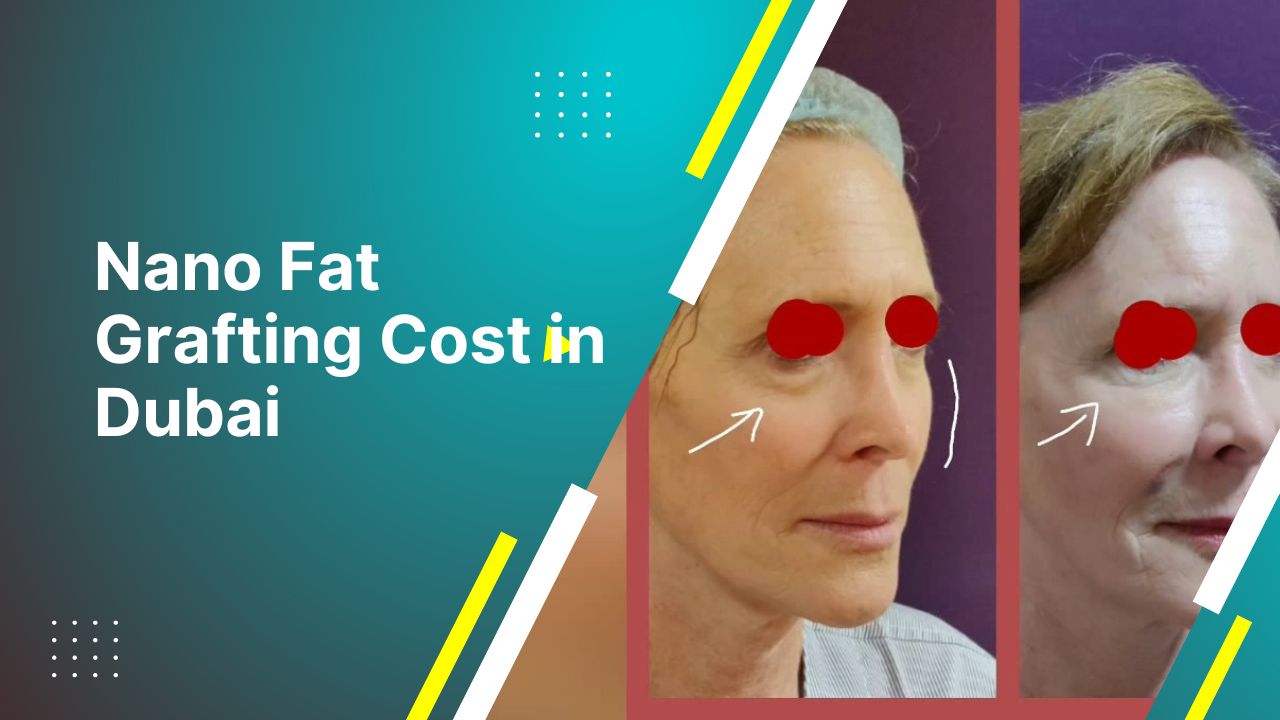 Nano Fat Grafting Cost In Dubai
