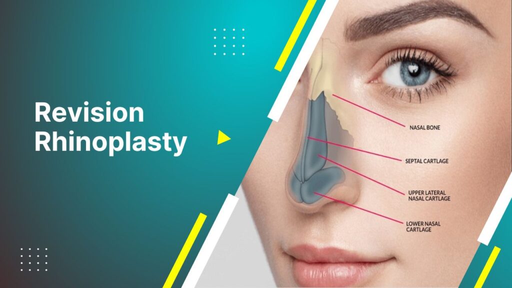 Revision Rhinoplasty 2024