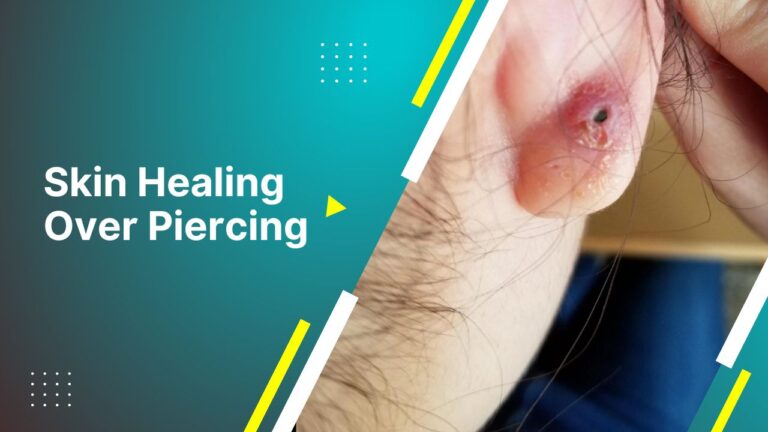 Skin Healing Over Piercing