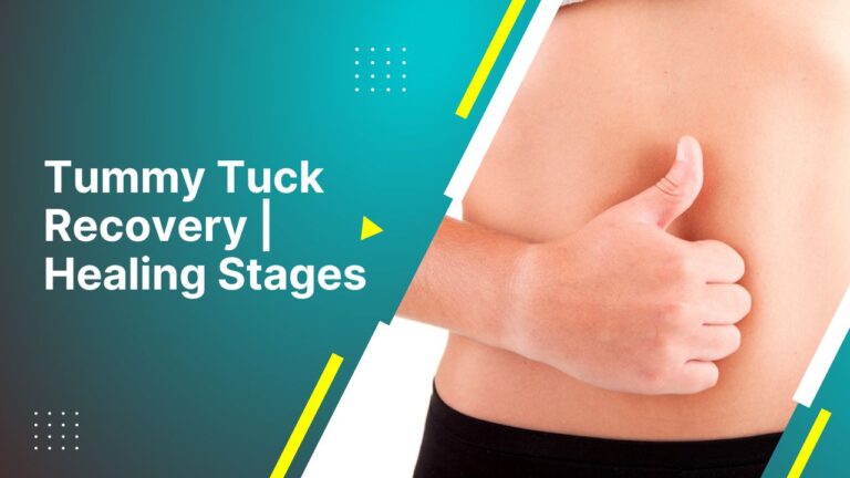 Tummy Tuck Recovery | Healing Stages And Tips-Modified