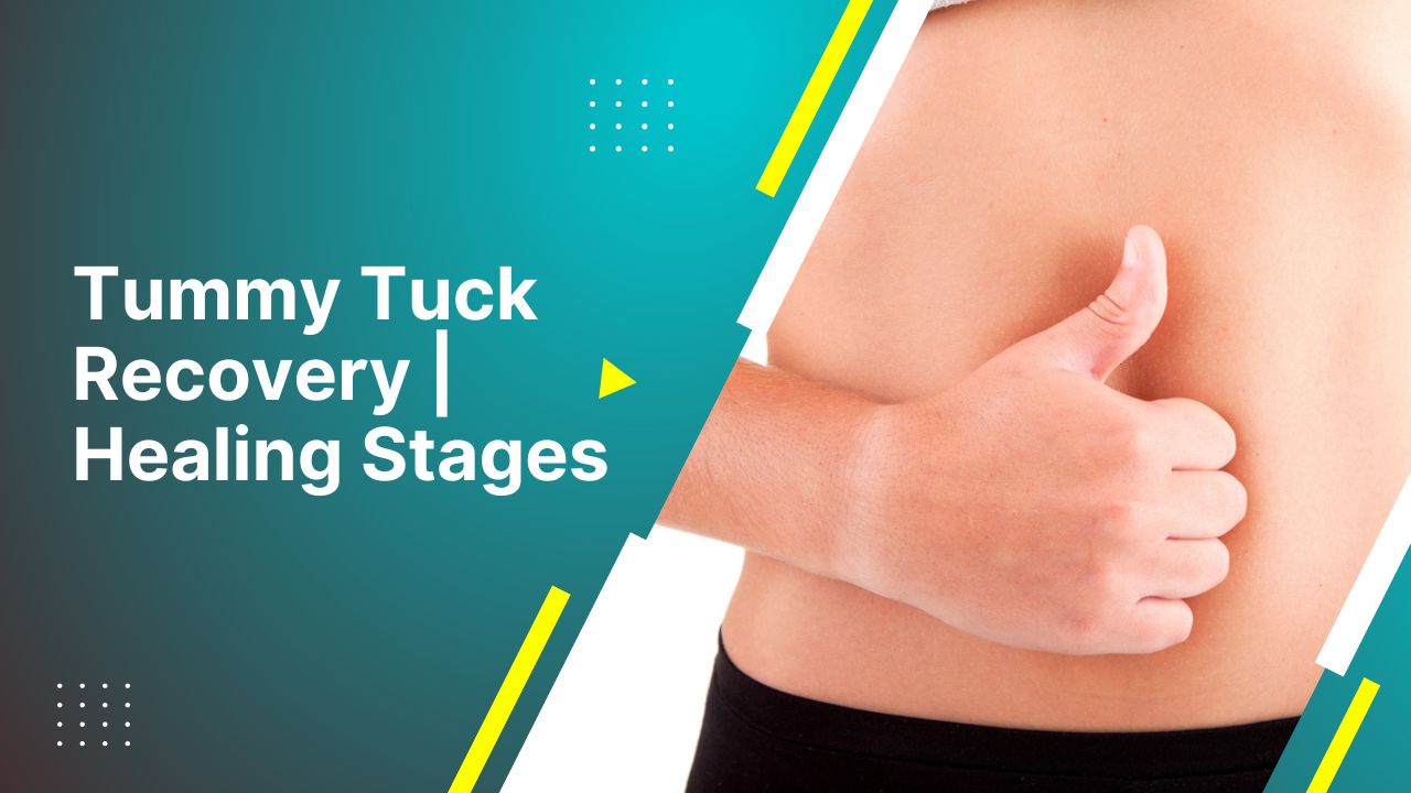 Tummy Tuck Recovery  Healing Stages And Tips-Modified 2024