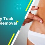 Tummy Tuck Scars Removal  Can Tummy Tuck Scars Be Removed