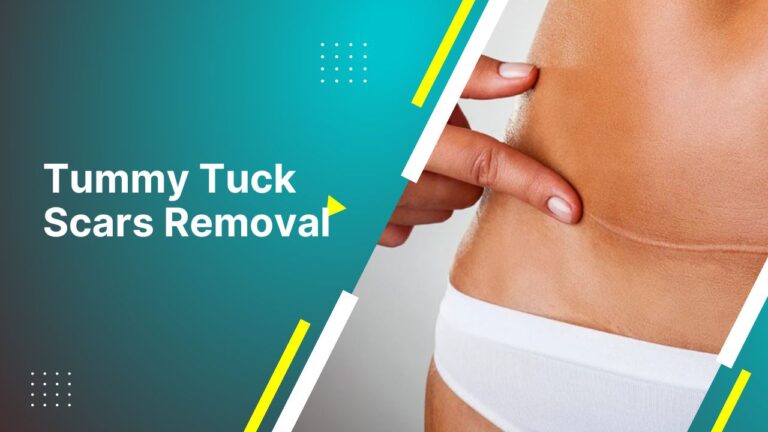 Tummy Tuck Scars Removal | Can Tummy Tuck Scars Be Removed?