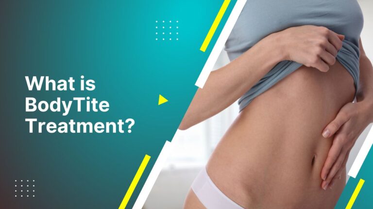 What Is Bodytite Treatment?