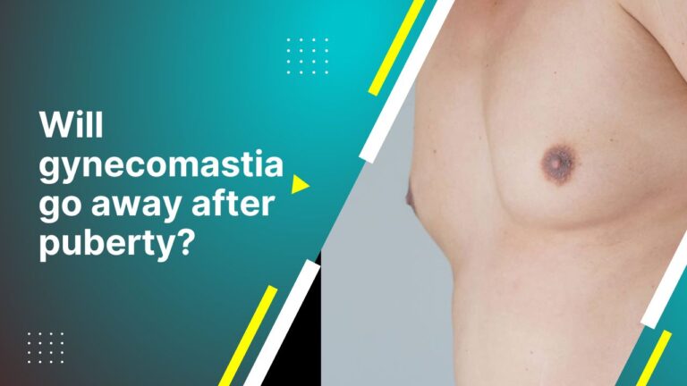 Will Gynecomastia Go Away After Puberty?