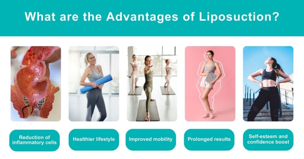 Advantages Of Liposuction | Explained By Dr. Tarek Bayazid
