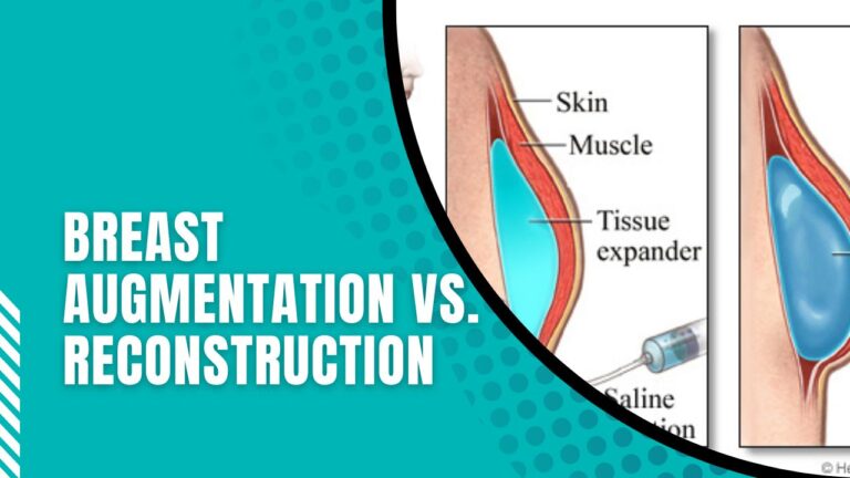 Breast Augmentation Vs. Reconstruction