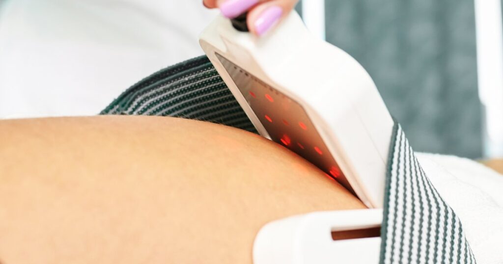 Laser-Assisted Liposuction