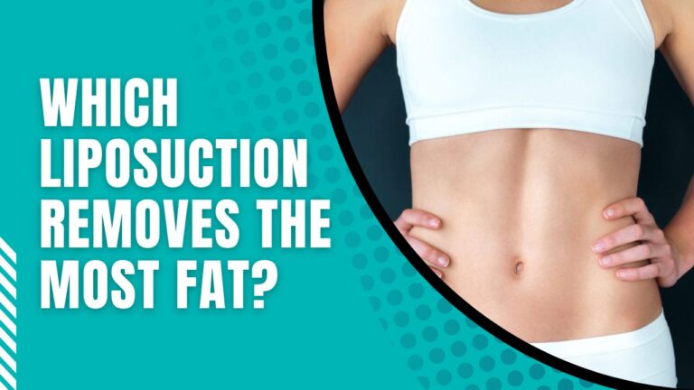Which Liposuction Removes The Most Fat? | Can Liposuction Remove 100 Pounds?