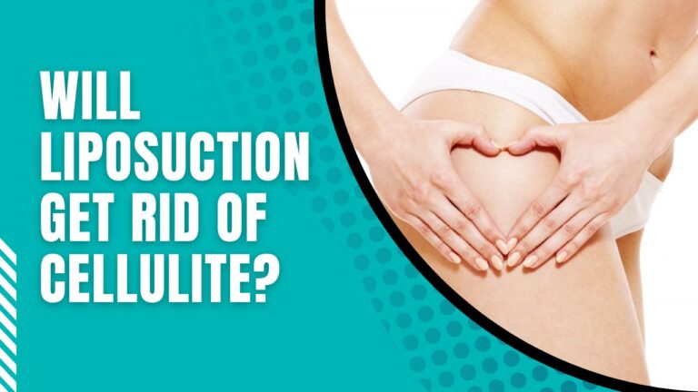 Will Liposuction Get Rid Of Cellulite? | Will Liposuction Help Cellulite?
