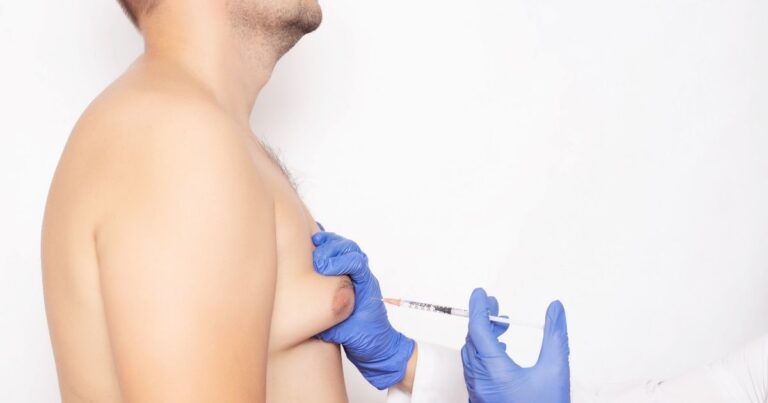 From Gynecomastia To Confidence_ How Breast Reduction Can Improve Men’s Mental Well Being