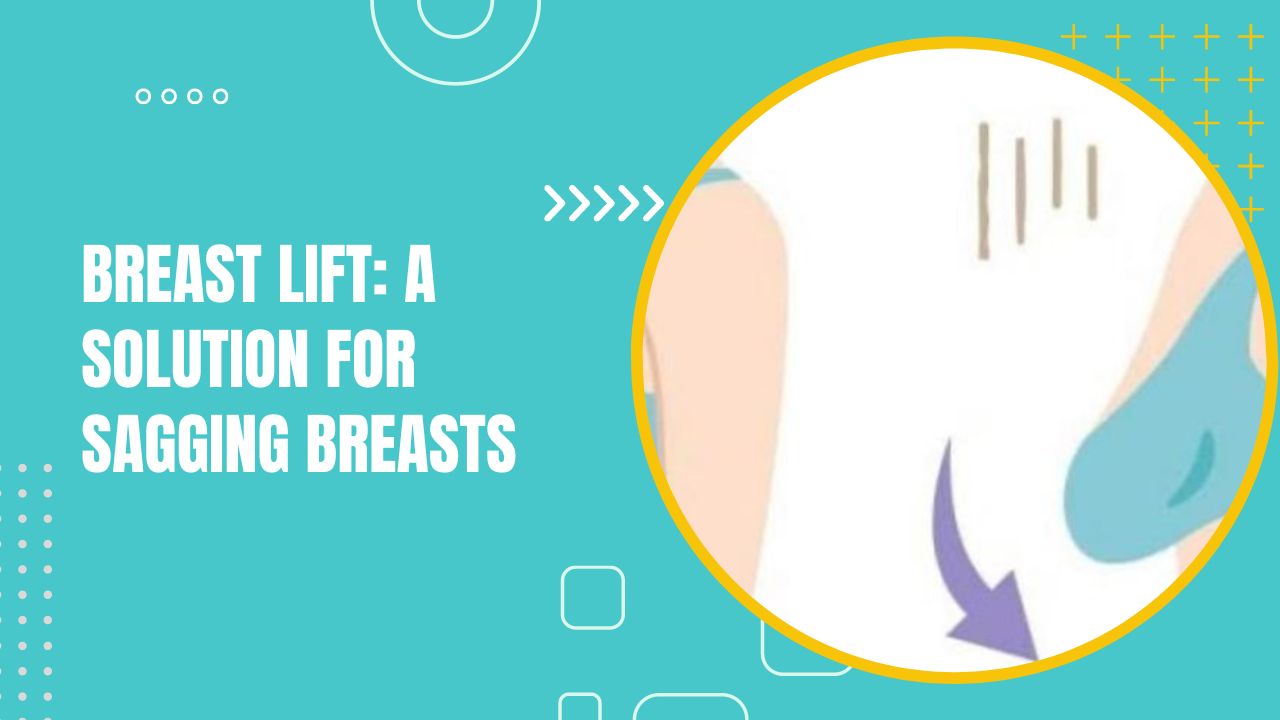 Breast Lift: A Solution For Sagging Breasts