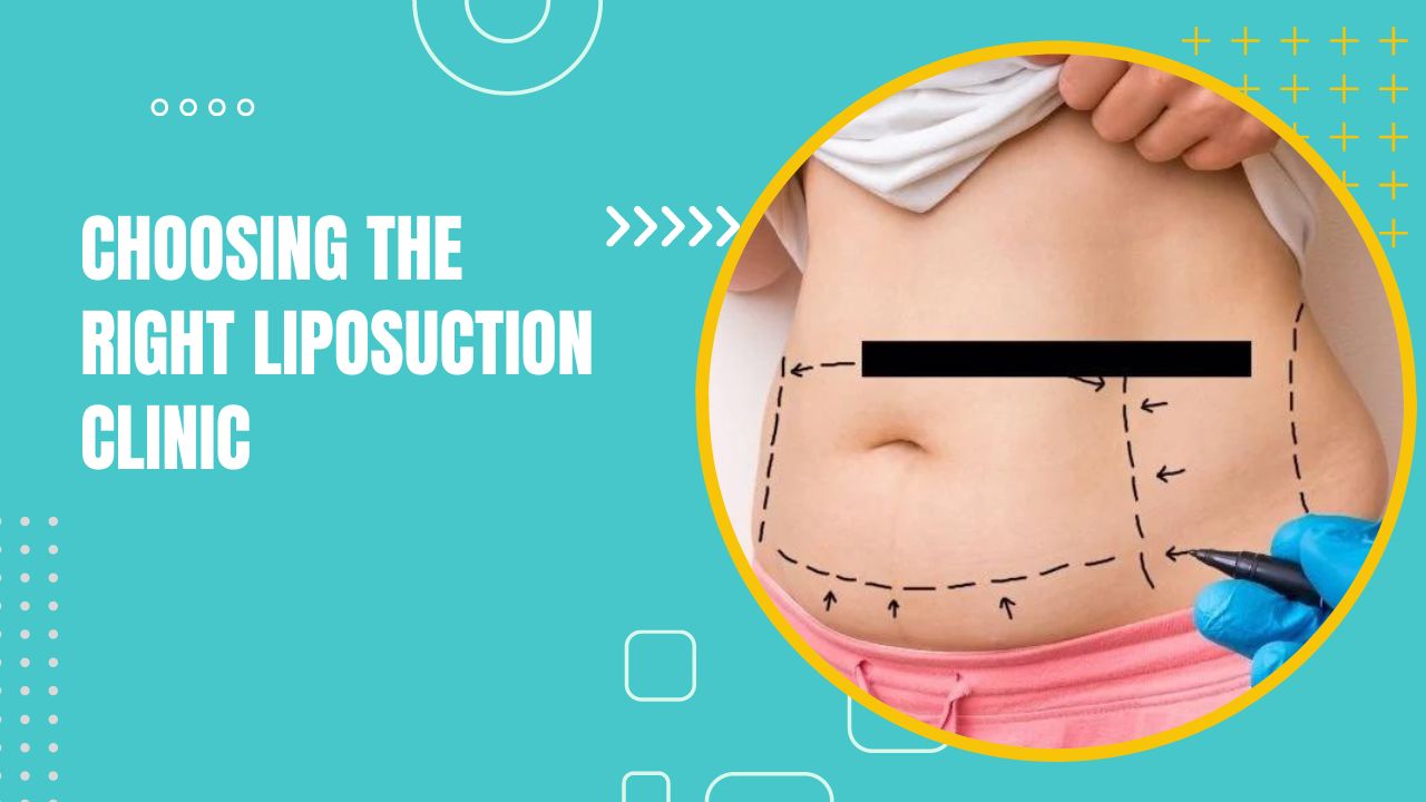Choosing The Right Liposuction Clinic: Top Factors To Consider