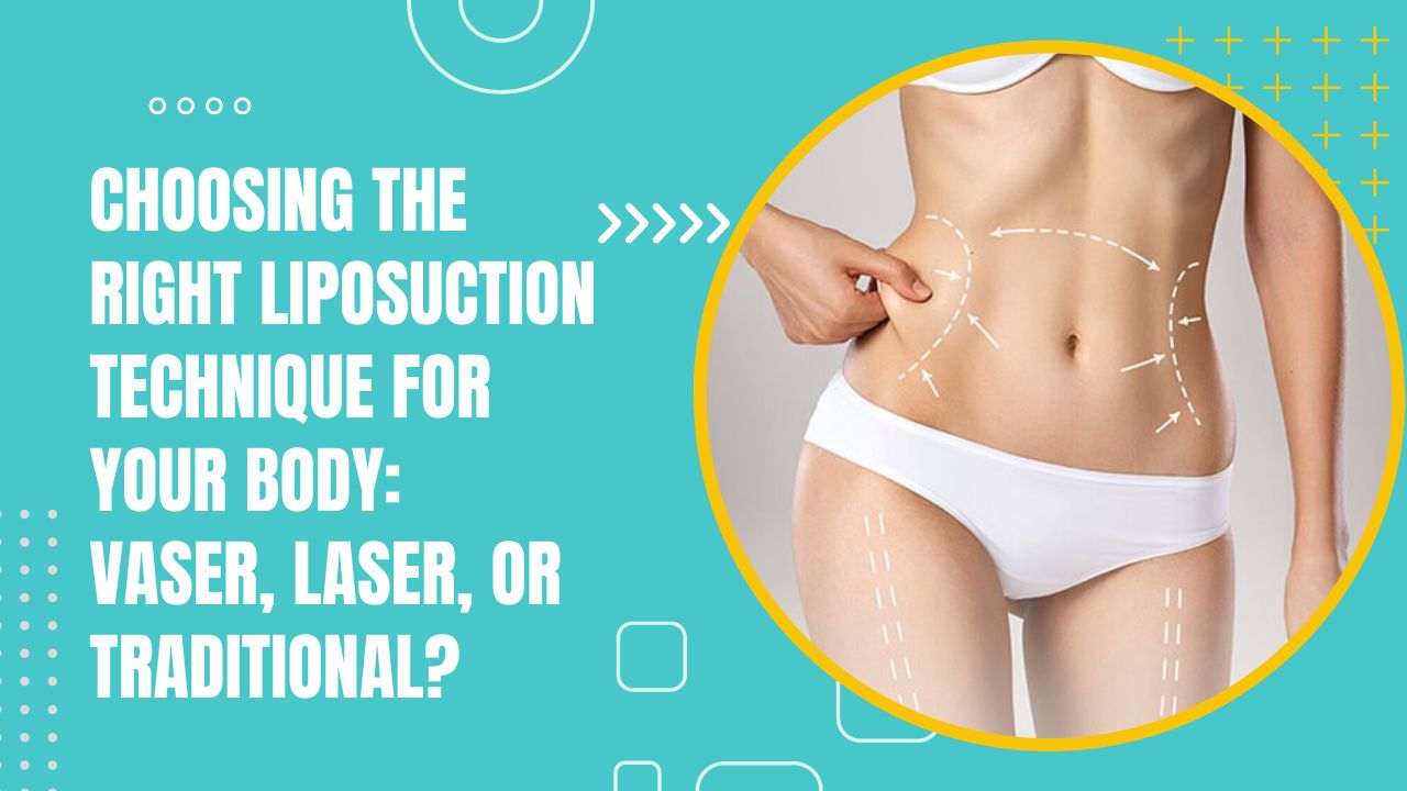 Choosing The Right Liposuction Technique For Your Body: Vaser, Laser, Or Traditional?