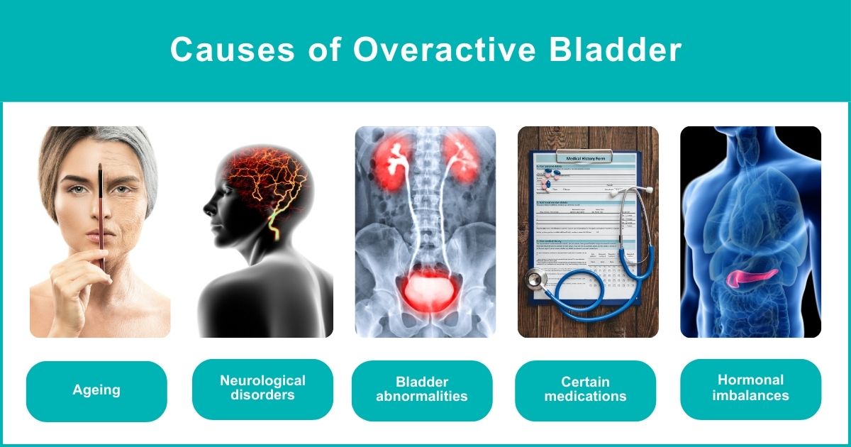 How Botox Injections Can Help You With An Overactive Bladder 2025