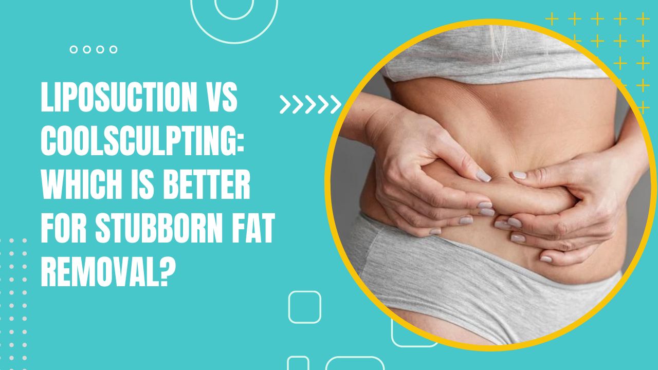 Liposuction Vs CoolSculpting: Which Is Better For Stubborn Fat Removal? 2024