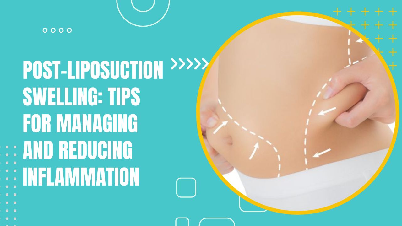 Post-Liposuction Swelling: Tips For Managing And Reducing Inflammation