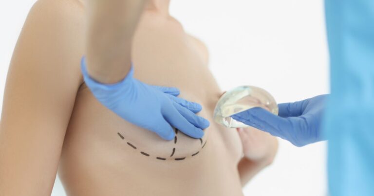 Breast Augmentation For Cancer Survivors: Reconstruction Options